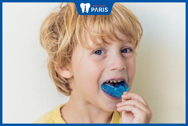 Trẻ có thể niềng răng từ 6 tuổi