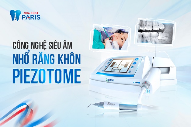 Nhổ răng khôn bằng máy Piezotome là dịch vụ đang được triển khai tại Nha Khoa Paris