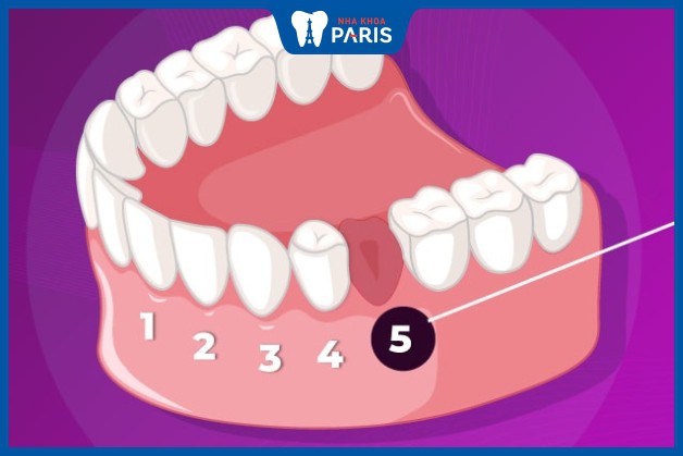 Răng hàm nhỏ số 5 đóng vai trò nhai, xé thức ăn hỗ trợ cho răng số 6 và 7