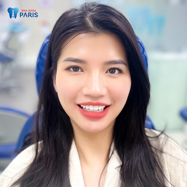 Sau khi hoàn thành, chị Thanh rất tự tin với hàm răng của mình