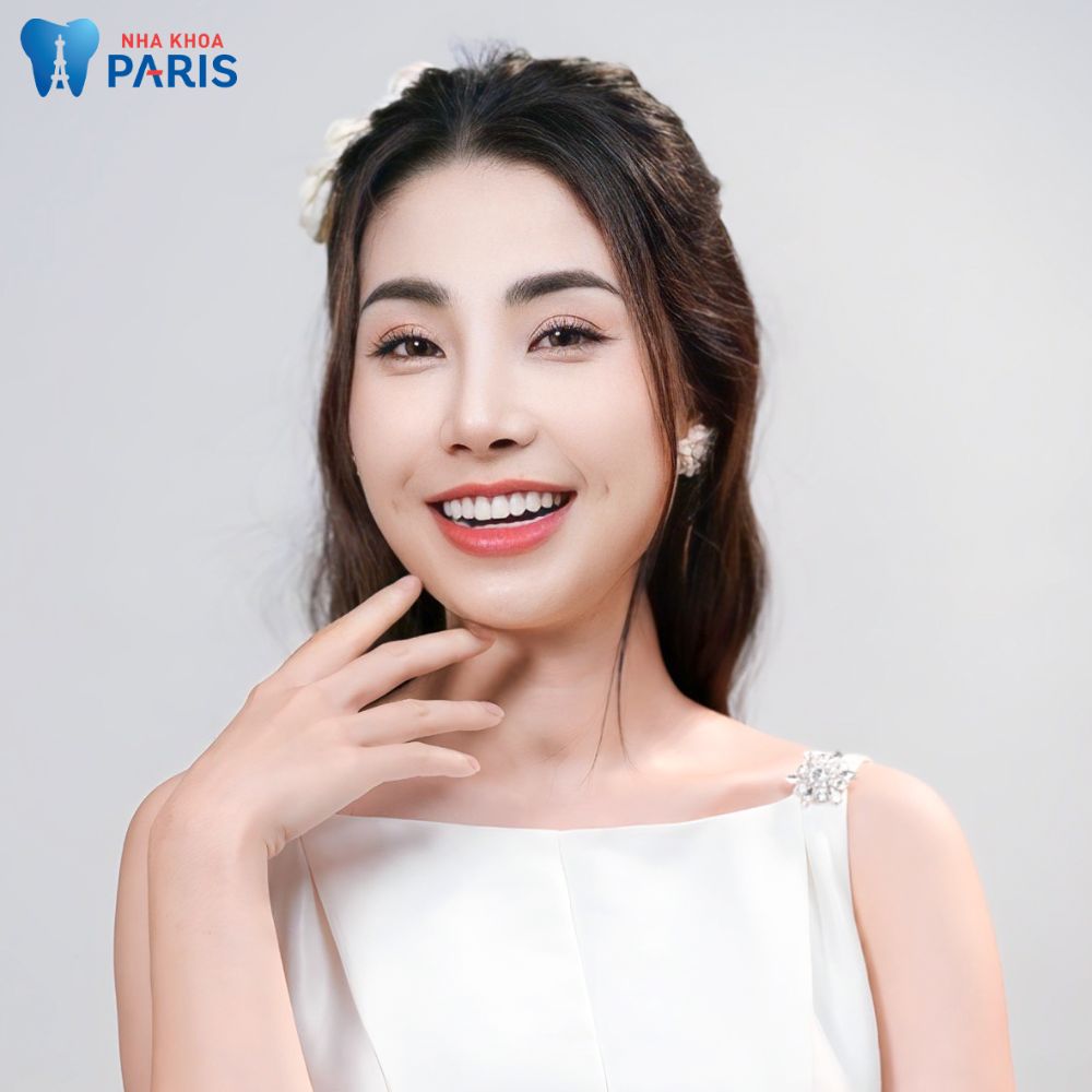 Nụ cười rạng rỡ sau khi bọc sứ DDBio