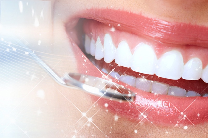 Răng sứ kim cương sáng bóng, thẩm mỹ tự nhiên có xuất xứ tại Đức