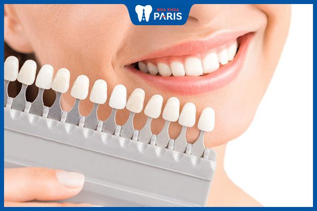 Răng sứ toàn sứ Nacera có mức giá cao hơn nhiều so với răng sứ kim loại