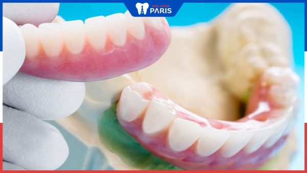 Răng sứ tháo lắp: Ưu nhược điểm và quy trình phục hình răng