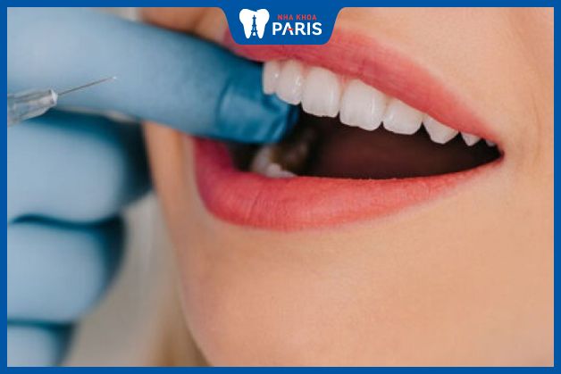 Gây tê giúp giảm bớt đau đớn trước khi bọc răng sứ