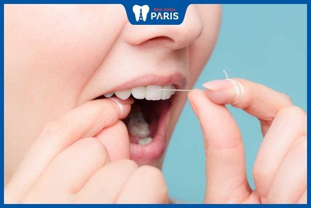 Dùng chỉ nha khoa giúp ngăn ngừa sâu răng