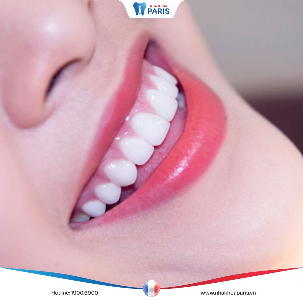 Khi nào cần thay răng sứ mới? Thay răng sứ an toàn, hiệu quả – Lựa chọn nha khoa uy tín