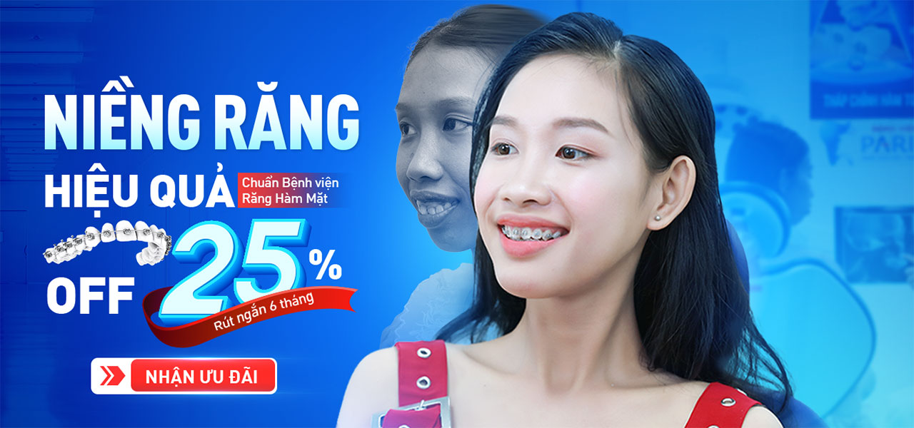 Nha khoa Paris – Niềng răng 3D Speed – 6 tháng đều đẹp