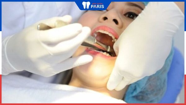 Tiểu phẫu răng khôn là gì? Quy trình và lưu ý khi thực hiện
