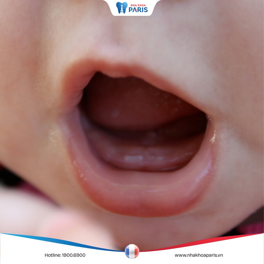 Trẻ mọc răng: Dấu hiệu, mẹo giảm đau & cách chăm sóc đúng