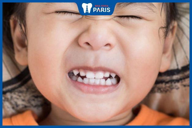 Hiện tượng nghiến răng có thể biến mất khi trẻ lớn