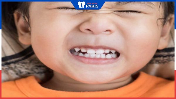 Trẻ ngủ nghiến răng: Nguyên nhân, hậu quả và cách khắc phục