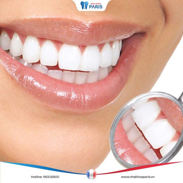 Bọc răng sứ uy tín TPHCM? Tiêu chí lựa chọn nha khoa tốt