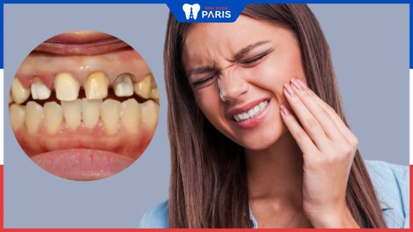 9 Hậu quả bọc răng sứ sai cách và biện pháp phòng tránh