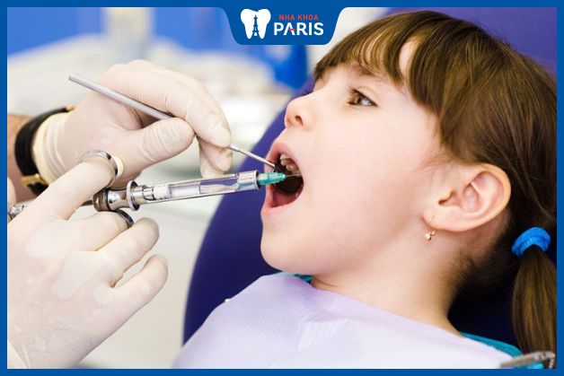 Quy trình nhổ răng sữa cho trẻ em