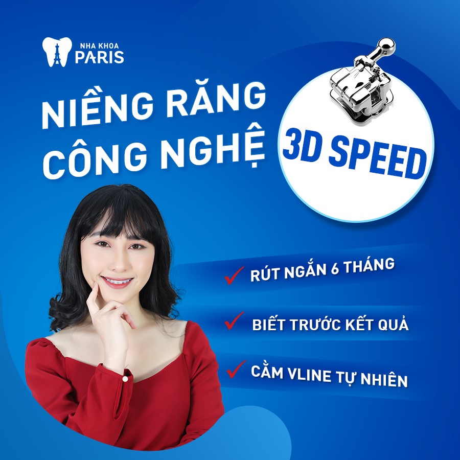 Nha Khoa Paris ứng dụng công nghệ 3D Speed