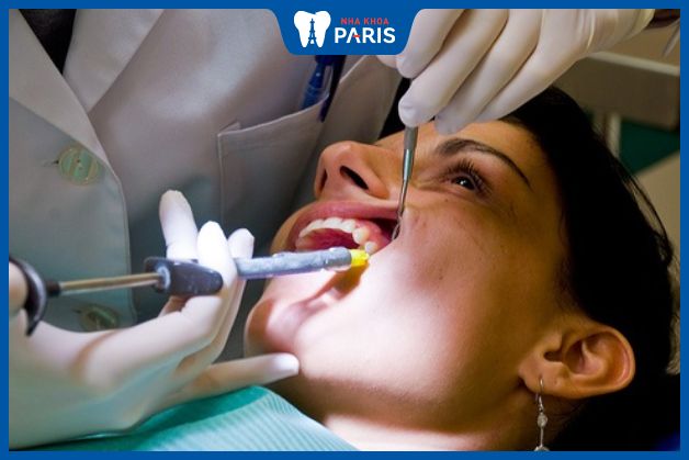 Quy trình thực hiện nhổ răng siêu âm
