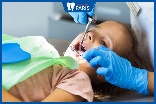 Quy trình niềng răng cho trẻ em