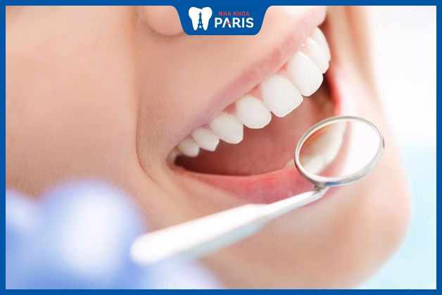 Yếu tố tác động đến chi phí bọc răng Cercon
