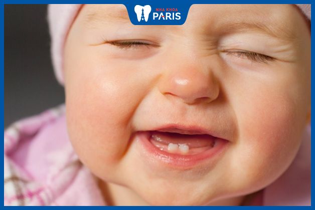 Lịch mọc răng sữa ở trẻ