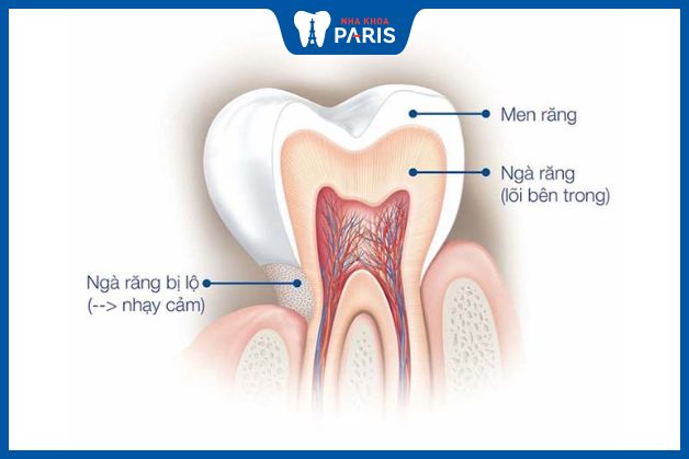 Men răng là lớp ngoài cùng của răng