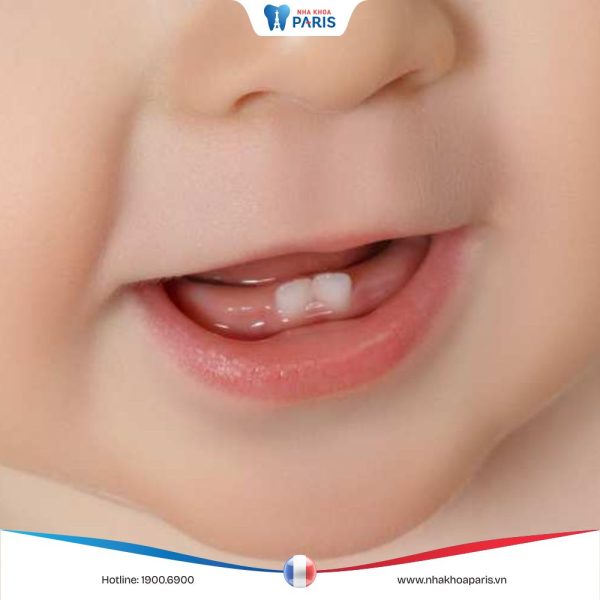 Quá trình mọc răng của trẻ như thế nào? Dấu hiệu nhận biết