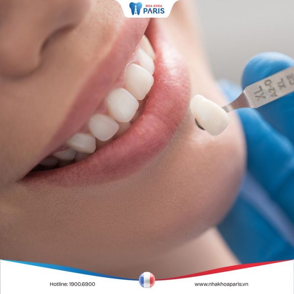 Tìm hiểu quy trình bọc răng sứ tiêu chuẩn và đảm bảo an toàn