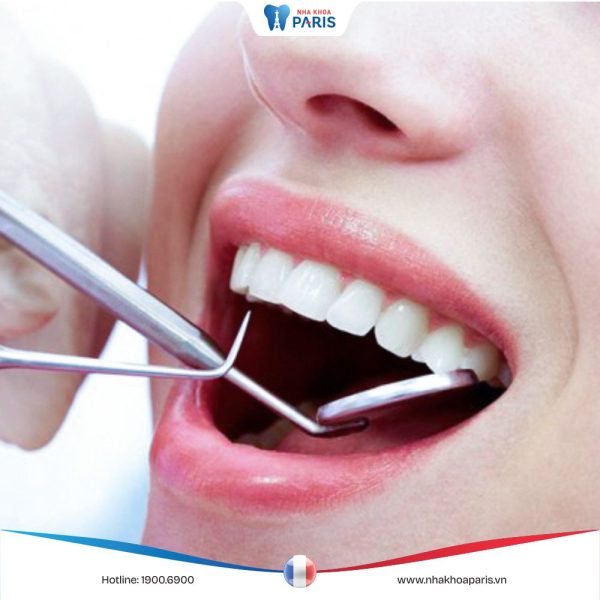 Giải đáp: Vì sao nha sĩ khuyên nên khám răng định kỳ 6 tháng