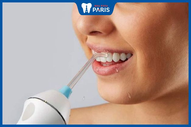 Bạn nên sử dụng máy tăm nước hàng để làm sạch răng miệng toàn diện