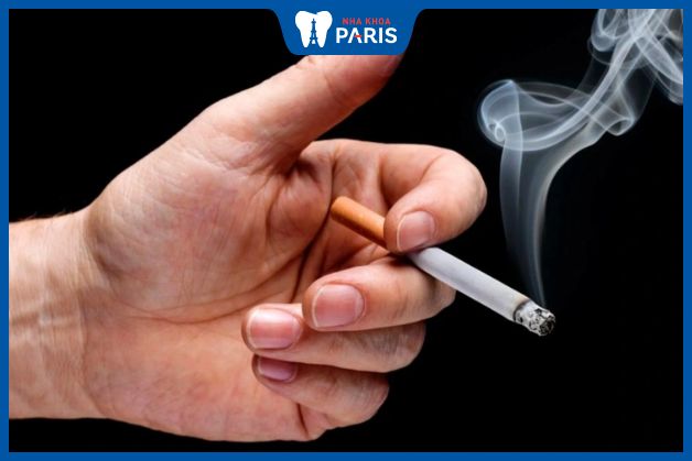 Hút thuốc lá làm tăng nguy cơ viêm lợi răng hàm