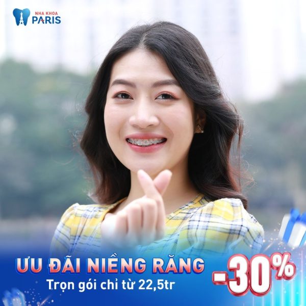 Ưu đãi dịch vụ niềng răng tại Nha khoa Paris