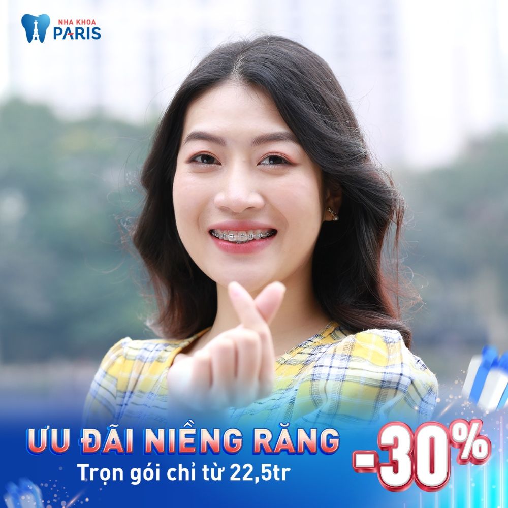 Ưu đãi dịch vụ niềng răng tại Nha khoa Paris