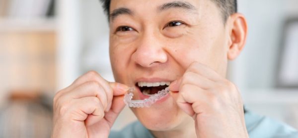 30 tuổi có niềng răng được không