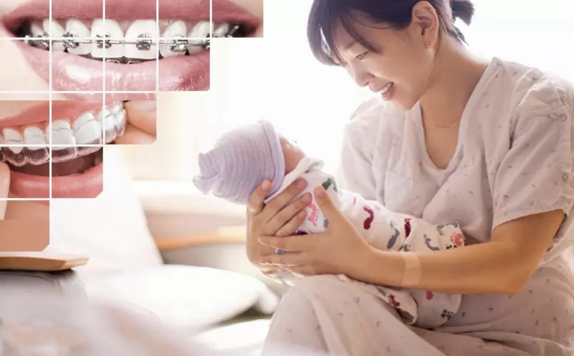 2 phương pháp niềng răng phổ biến để mẹ cân nhắc
