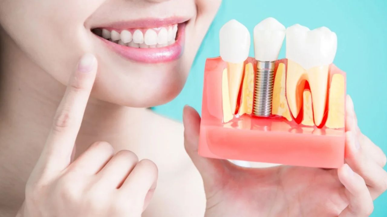 Trồng răng có ảnh hưởng gì không? Cần chú ý gì khi thực hiện