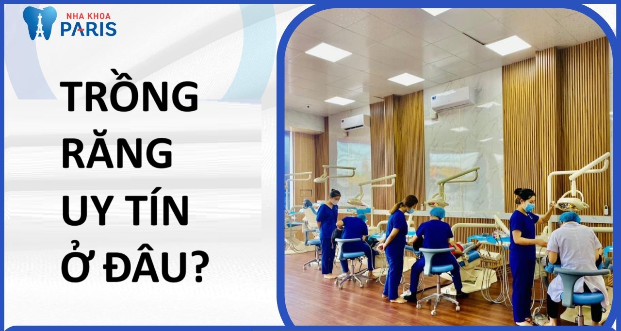 Trồng răng giả ở đâu tốt? Top 6+ địa chỉ uy tín tại Hà Nội