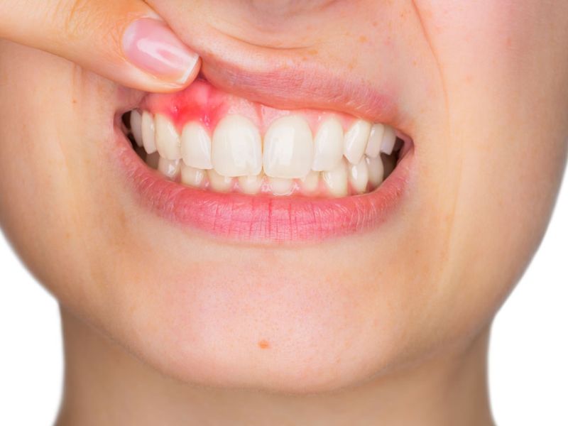 Trồng răng sứ bị đau có thể do nhiều nguyên nhân gây ra