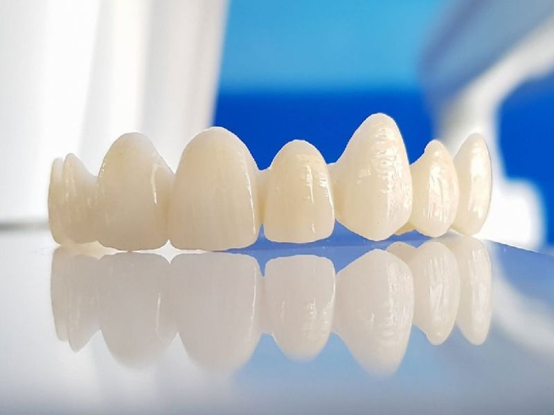 Răng sứ Zirconia là dòng toàn sứ cao cấp, có độ bền, tính thẩm mỹ tự nhiên và an toàn cho sức khỏe.