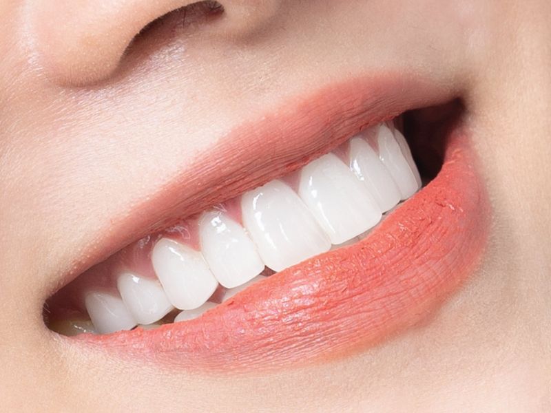 Đối tượng nên sử dụng răng sứ Zirconia