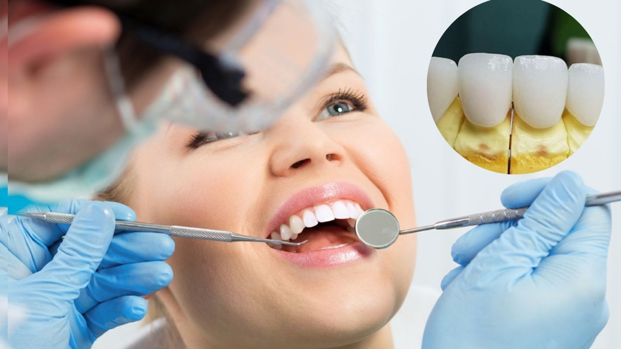 Răng sứ Zirconia có tốt không? dùng được bao lâu?