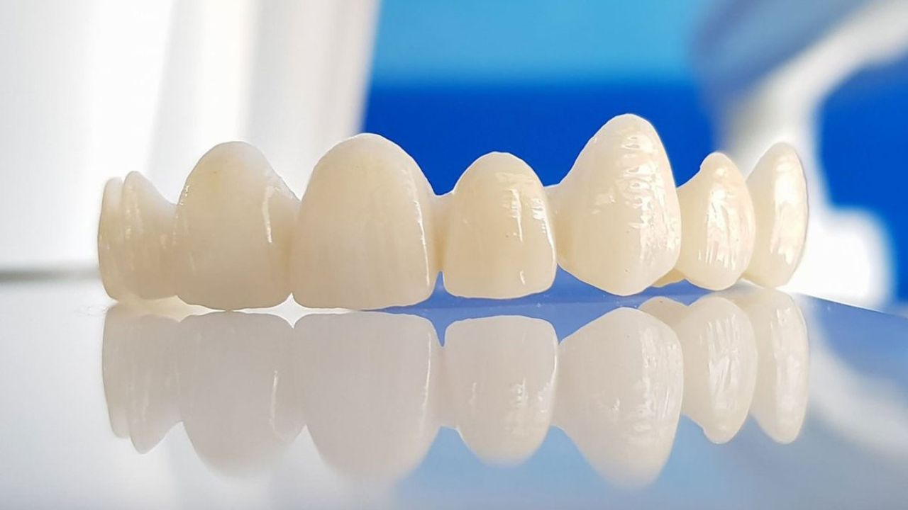 Răng sứ Cercon có mấy loại? Nên chọn loại Cercon nào?
