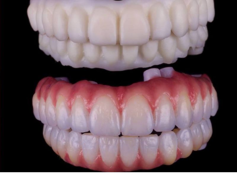 Bảng giá răng sứ HT Smile dao động từ 5.500.000đ - 10.000.000đ/răng.
