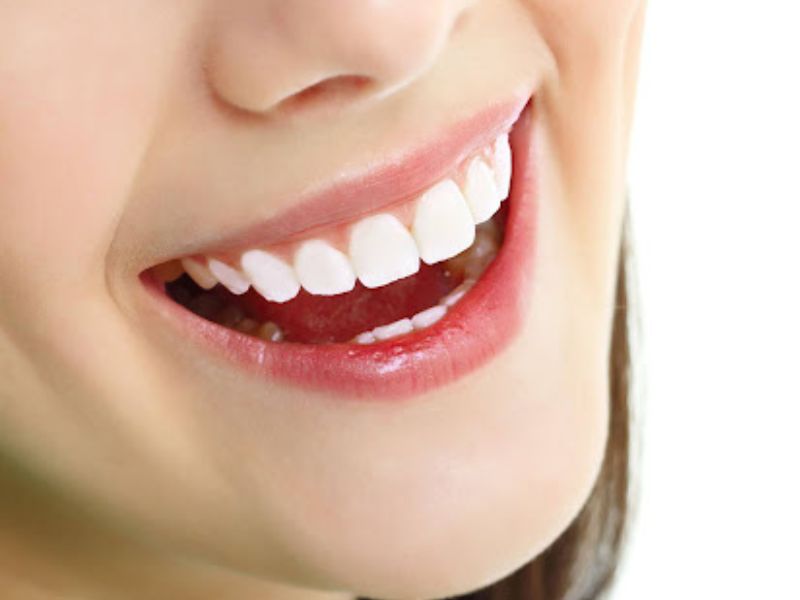 Răng sứ HT Smile – Sứ nguyên khối Đức 100%, thẩm mỹ cao, bền chắc theo thời gian.