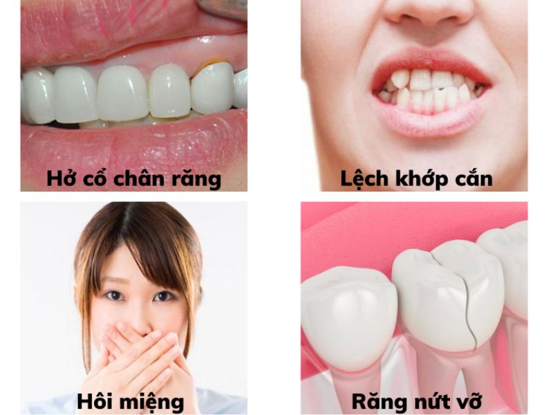 Biểu hiện bất thường sau khi bọc răng sứ