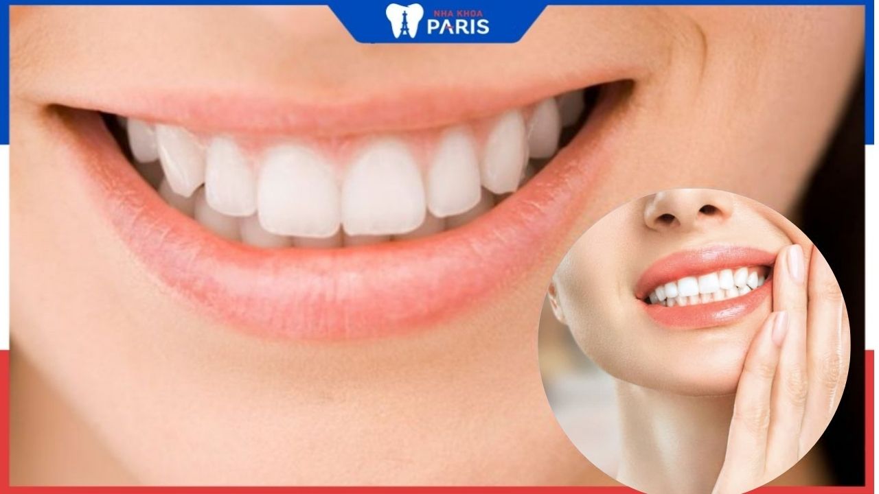 Biểu hiện sau khi bọc răng sứ: Bình thường hay bất thường?