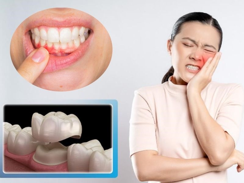 Nguyên nhân bọc răng sứ bị đau nướu