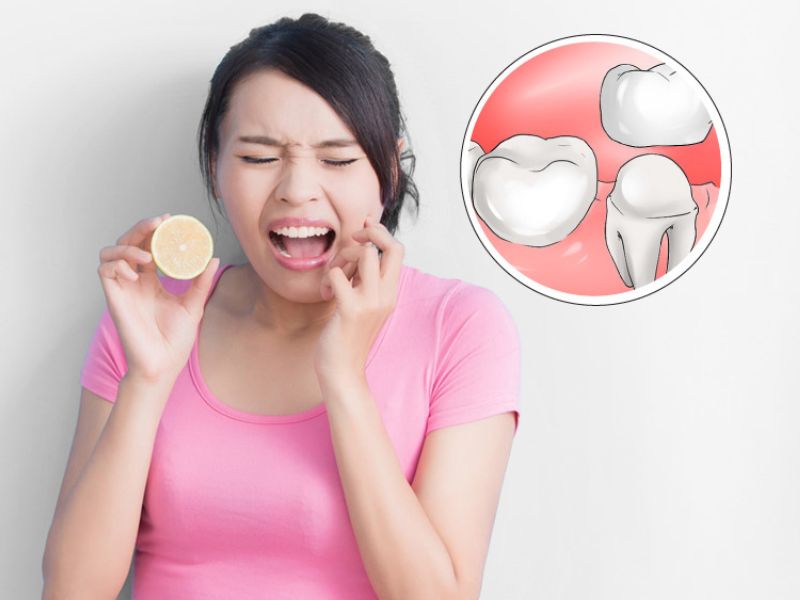 Bọc răng sứ bị nhức