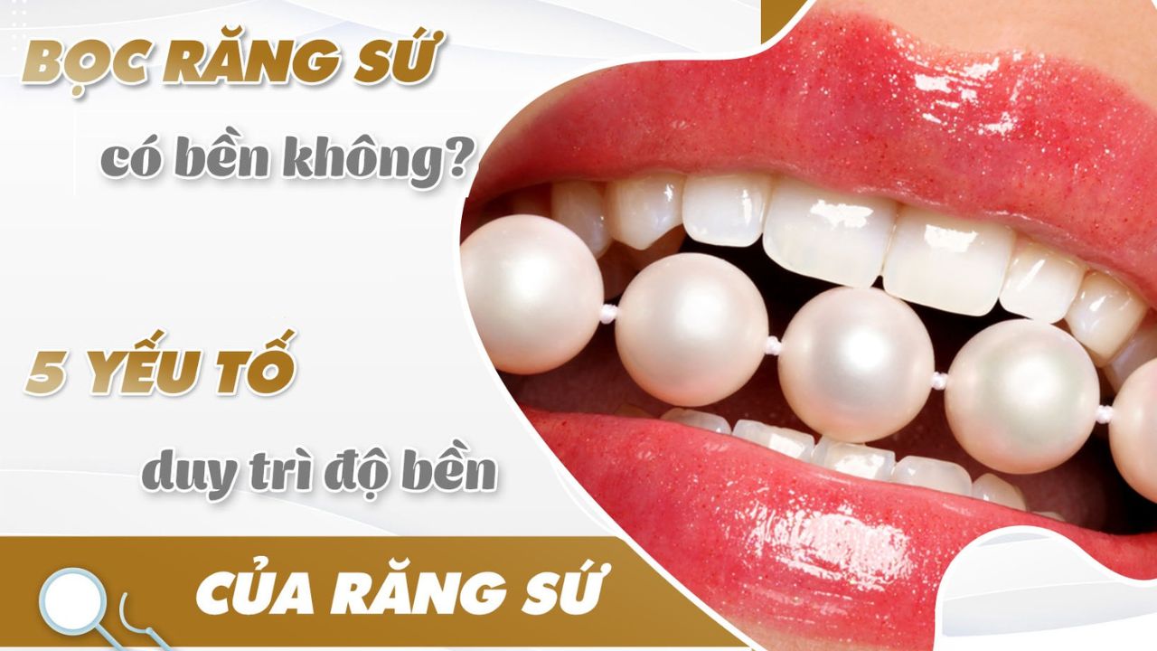 Bọc răng sứ có bền không? 5 yếu tố quyết định độ bền răng sứ