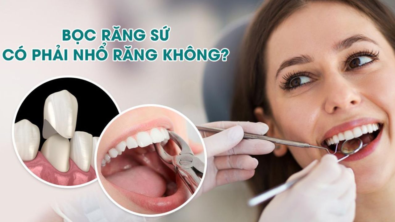 Bọc răng sứ có phải nhổ răng không?cần chú ý điều gì
