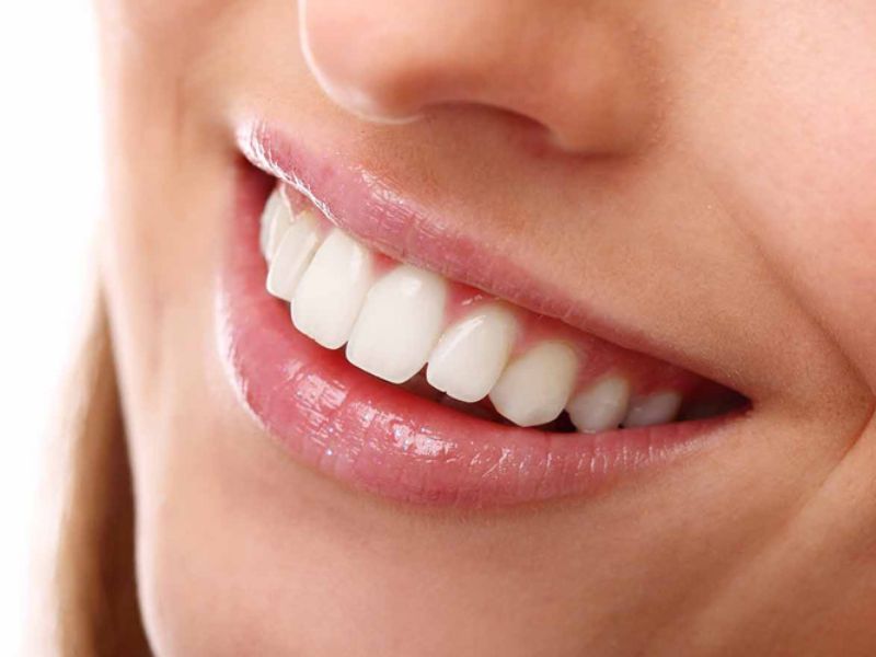 Răng sứ bọc lại lần 2 vẫn có độ bền cao, tương đương hoặc thậm chí tốt hơn lần đầu dao động từ 5 - 20 năm